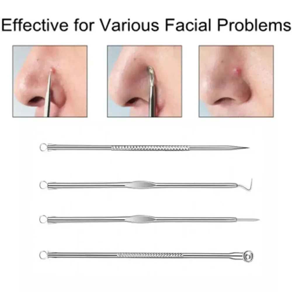 Stainless Steel Blackhead Remover Tools Set w/ Pimple Extractors 4 pc - Black