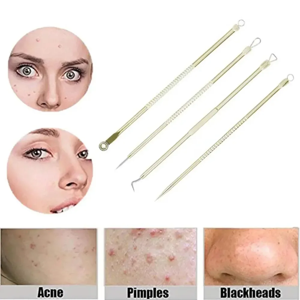 Stainless Steel Blackhead Remover Tools Set w/ Pimple Extractors 4 pc - Black